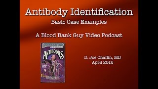 Antibody ID The Basics Part 1 [upl. by Hukill26]