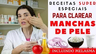 Acabe com as MANCHAS NA PELE inclusive MELASMA  Receita Caseira [upl. by Dyana]