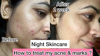 My Honest Night Skincare Routine 🌝  Aziderm 10 [upl. by Kessiah]