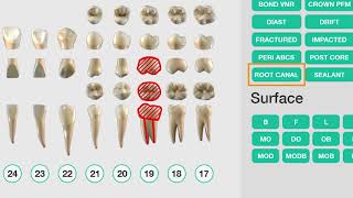 Dental Assisting  Patient Exam [upl. by Ruhnke]