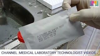 HPylori antigen rapid test in laboratoryHelicobacter pylori testHindi amp Urdu [upl. by Angus]