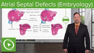 Normal Sinus Rhythm  EKG ECG Interpretation [upl. by Hoffarth646]