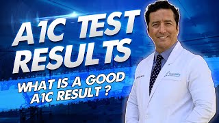 A1C test for Diabetes HbA1c  What is a Good A1C Test Result SUGARMD [upl. by Angel104]