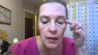 7 Month Retin A Anti Aging Skin Care Update [upl. by Hajile]