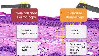 Principles of Dermoscopy  Dr Natalia Jaimes [upl. by Ahsinyd315]