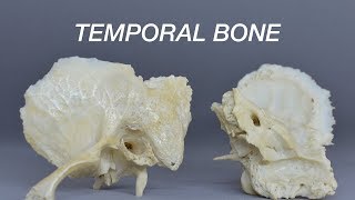 TEMPORAL BONE [upl. by Anaiuq]