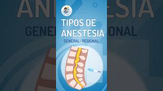 😴 TIPOS DE ANESTESIA LOCAL REGIONAL EPIDURAL Y GENERAL [upl. by Allisan9]