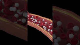 Platelets and plasma in blood [upl. by Agnes]