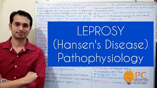 Leprosy Pathophysiology Hansens Disease Part 1 Introduction Types and Etiology [upl. by Obel]