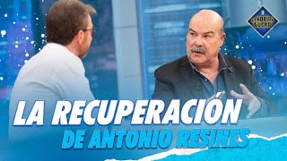 Resines y los días previos a su ingreso por Covid  El Hormiguero [upl. by Elleiad880]