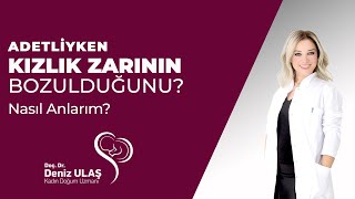 Adetliyken Kızlık Zarının Bozulduğunu Nasıl Anlarım [upl. by Eidac]