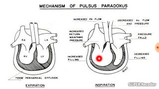 Arterial pulsevariations [upl. by Aleunam]