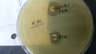 Beta Lactamase detection [upl. by Nayd48]