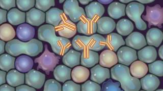 Treating Follicular Lymphoma [upl. by Ayra]