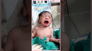 Neonatal baby just after birth admit in nicu newbornbaby doctor hospital 🏥subscribemychannel 🙏🙏🙏 [upl. by Boone]