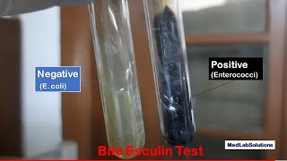 Bile Esculin Test Positive and Negative Demonstration [upl. by Anig323]