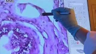 Laser Microdissection Introduction to MMI System [upl. by Axel]