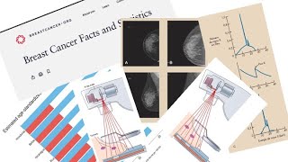 Mamografía para técnicos radiólogos  Introducción a la Imagenología  UNAH [upl. by Pompea]