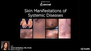 Skin Manifestations of Systemic Disease  November 5 2020 [upl. by Lora48]