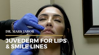 Juvederm Lips amp Smile Lines  Dr Mark Jabor [upl. by Antonio]