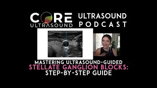 Mastering UltrasoundGuided Stellate Ganglion Blocks StepbyStep Guide [upl. by Halford768]