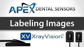 Apteryx XrayVision Labeling Images  Apex Dental Sensors  Training [upl. by Zolner862]