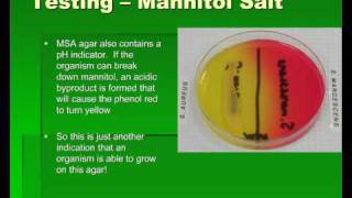 Introduction to Streptococcus [upl. by Esta]