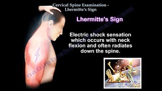 Cervical Spine Examination Lhermittes Sign  Everything You Need To Know  Dr Nabil Ebraheim [upl. by Previdi]