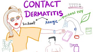 Contact Dermatitis [upl. by Eppillihp]