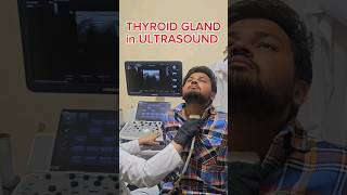 THYROID GLAND ULTRASOUND VIEW ☢️ ultrasound sonography thyroid thyroxine radiology mbbs [upl. by Kendry]