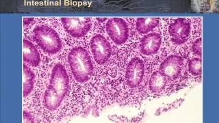 T Cell Effector Function Part 2  Th17 and T Regulatory Cells in Health and Disease [upl. by Tevlev]