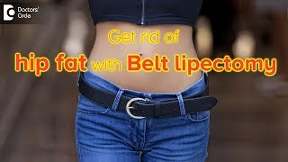 What is a lower body lift or Belt lipectomy  Dr Srikanth V [upl. by Hastie944]