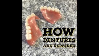 How Dentures Are RepairedFixed [upl. by Assetnoc]