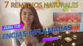 COMO CURAR ENCIAS INFLAMADAS REMEDIOS CASEROS PARA ENCIAS INFLAMADAS TRATAMIENTO PARA ENCIAS [upl. by Aanas]