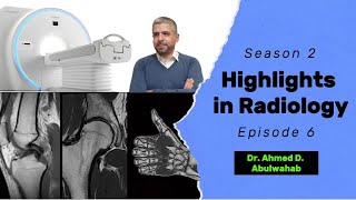 Highlights in Radiology S2 E6 anterior cruciate ligament tear [upl. by Merell523]