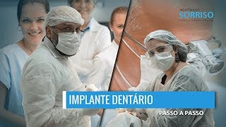 Implante Dentário  Passo a Passo  Indústria do Sorriso [upl. by Diba826]