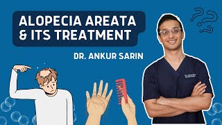 Alopecia Areata Treatment  Injections natural remedies treatment in Hindi  Dr Ankur Sarin [upl. by Semreh]