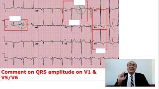 EKG Trainer Case 5 Questions [upl. by Branden425]