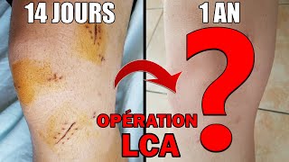 OPÉRATION LCA Ép 19  et les cicatrices [upl. by Lotty]