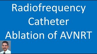 AV node reentry tachycardia atrial activation with 3D mapping [upl. by Atin636]