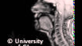 Voiceless uvular fricative MRI [upl. by Letnoj]