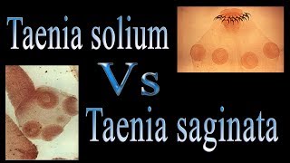 Difference between Taenia solium and Taenia saginata  Tsolium Vs Tsaginata [upl. by Htedirem]