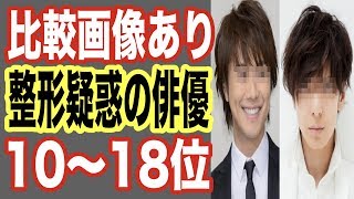 【裏情報】整形疑惑の男性芸能人ランキング10〜18位！前後のビフォーアフター画像あり！ジャニーズアイドルも…【世界の果てまで芸能裏情報チャンネル】 [upl. by Laemsi242]