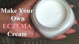 Eczema Be Gone How To Make Your Own Eczema Cream [upl. by Nador57]