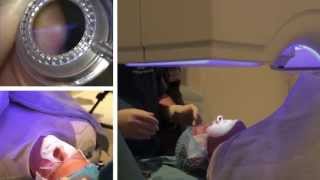 London Vision Clinic  LASIK  Live laser eye surgery  Professor Dan Reinstein [upl. by Innis868]