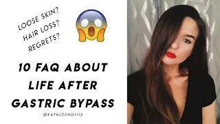 FAQs About Life After Gastric Bypass Surgery  WLS [upl. by Eirrak289]