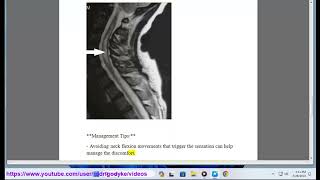 lhermitte sign 101 lhermittes sign differential diagnosis [upl. by Adriell]