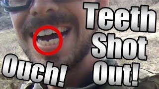 Airsoft Funny Moments and Fails Ep 9  Teeth Shot Out AGAIN Tactical Cows and More [upl. by Carbo409]