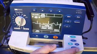 Transcutaneous Pacing [upl. by Imat]