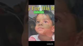 Cerebral Palsy  Kids Disease  Baby Illness babyvideo trending [upl. by Ahsinom]